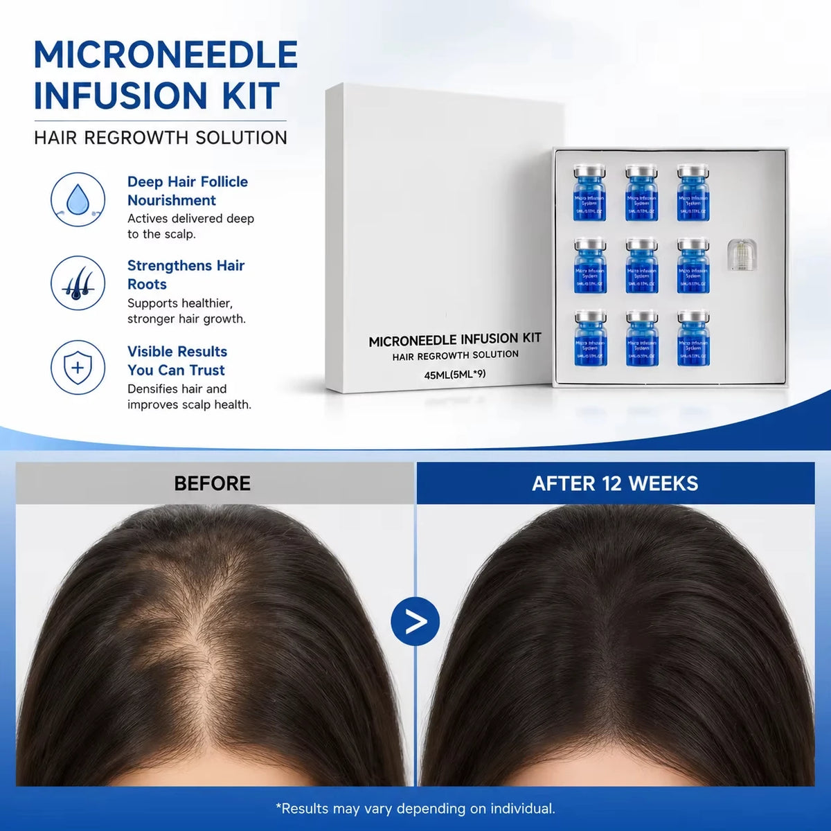 Revitalize Your Hair with Our Microneedle Hair Regrowth Kit & Nourishing Scalp Serum for Optimal Hair Health