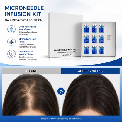 Revitalize Your Hair with Our Microneedle Hair Regrowth Kit & Nourishing Scalp Serum for Optimal Hair Health