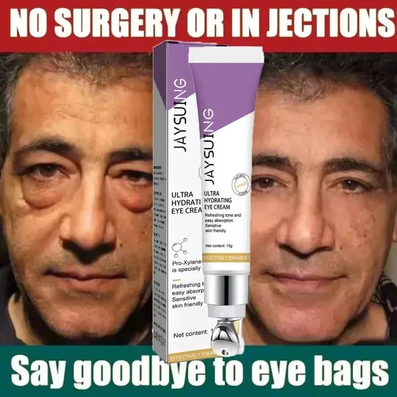 Revitalize Your Eyes with Instant Eye Bag Removal Cream - Anti-Wrinkle, Firming, and Brightening Formula for Youthful Skin