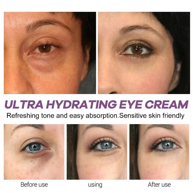 Revitalize Your Eyes with Instant Eye Bag Removal Cream - Anti-Wrinkle, Firming, and Brightening Formula for Youthful Skin