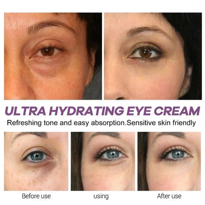 Revitalize Your Eyes with Instant Eye Bag Removal Cream - Anti-Wrinkle, Firming, and Brightening Formula for Youthful Skin